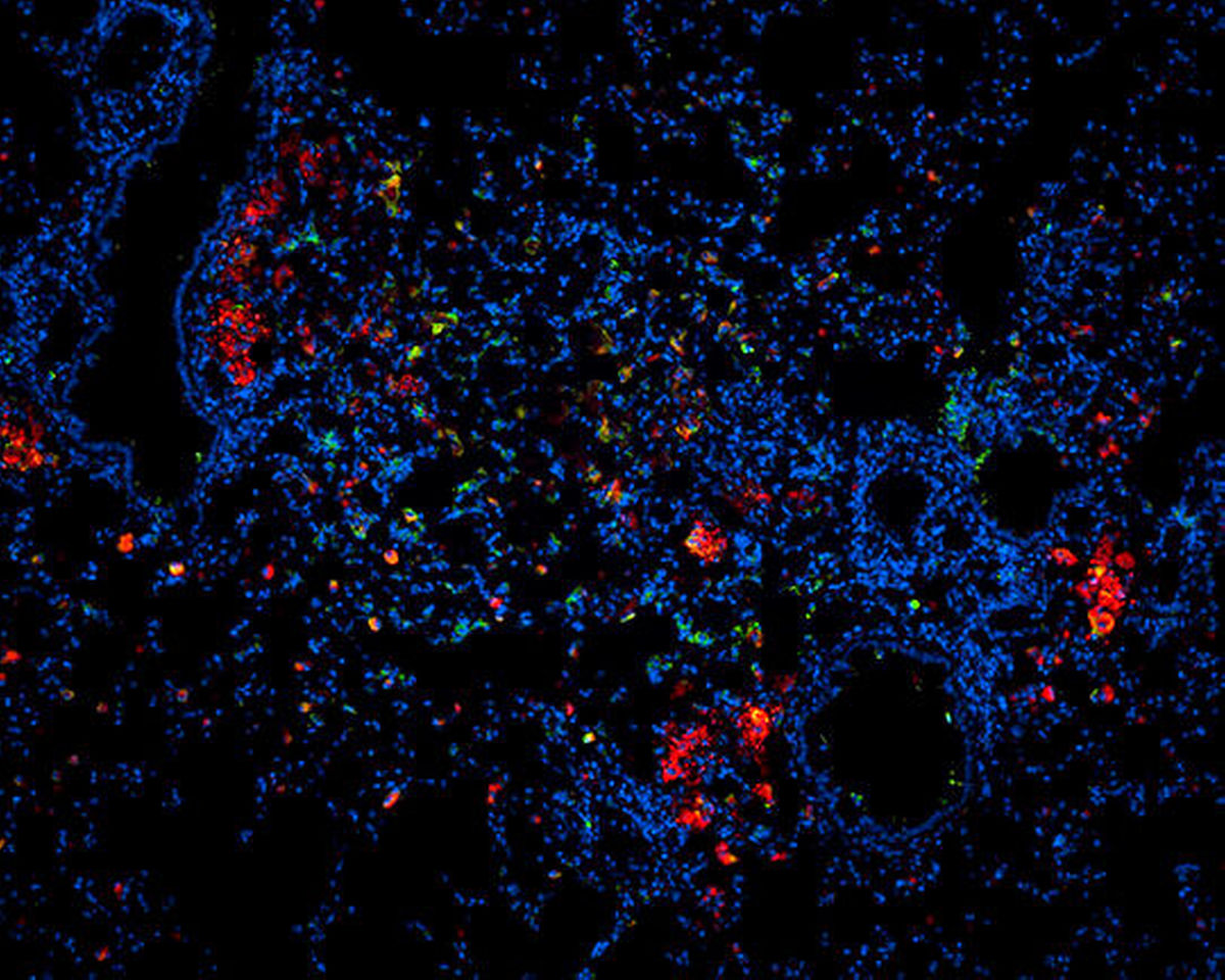 Abb. Die Mikroskopaufnahme eines Lungenschnittes einer mit TB infizierten Maus zeigt in Rot die Wirkstoff-Nanopartikel © FZB Zelluläre Mikrobiologie, Dr. N. Redinger