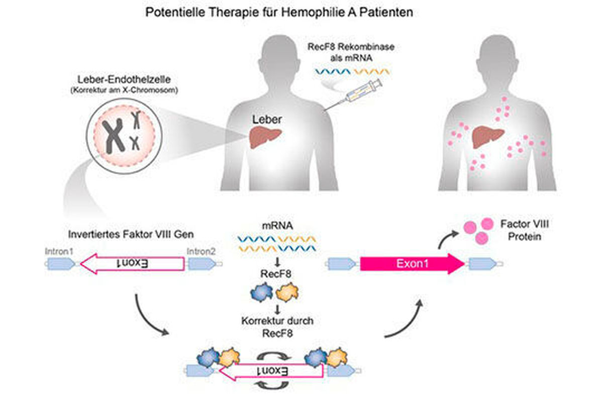 Abb. 1: Schematische Darstellung der möglichen Anwendung der Designer-Rekombinase RecF8 zur Korrektur der Gen-Inversion im Faktor VIII-Gen.