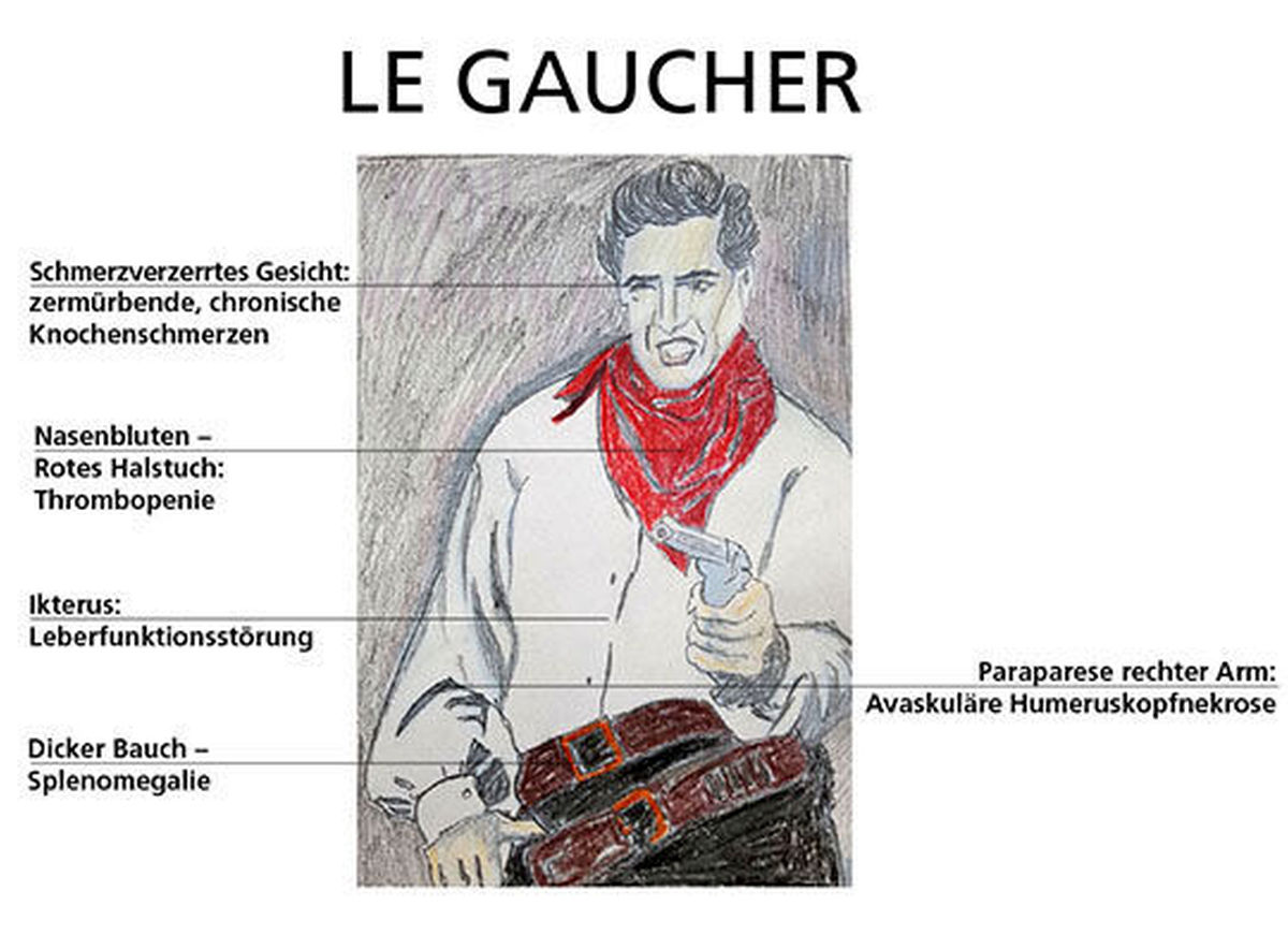 Abb.1: Le Gaucher