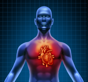 Herzmuskelentzündung: Impella-Pumpe als dauerhaftes Implantat