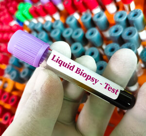 Liquid Biopsy bei Lungenkrebs