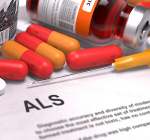 ALS: Subtypen und Geschlechtsunterschiede