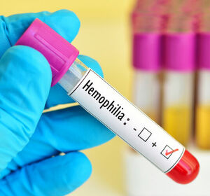 Hämophilie A und B: Zulassungsempfehlung für Marstacimab