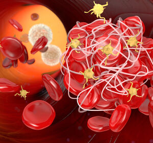 Neuer Mechanismus bei Venenthrombosen entdeckt – Thrombozyten als therapeutisches Ziel