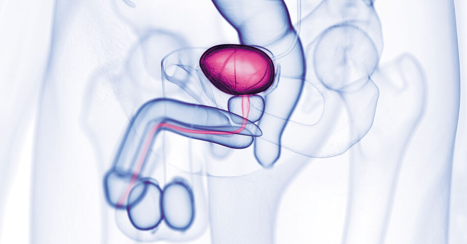 Systemische Therapie des metastasierten Urothelkarzinoms: Aktuelle Standards und Ausblick