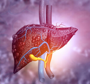 Mikrobiom-Signaturen ermöglichen präzise Diagnosen der NAFLD