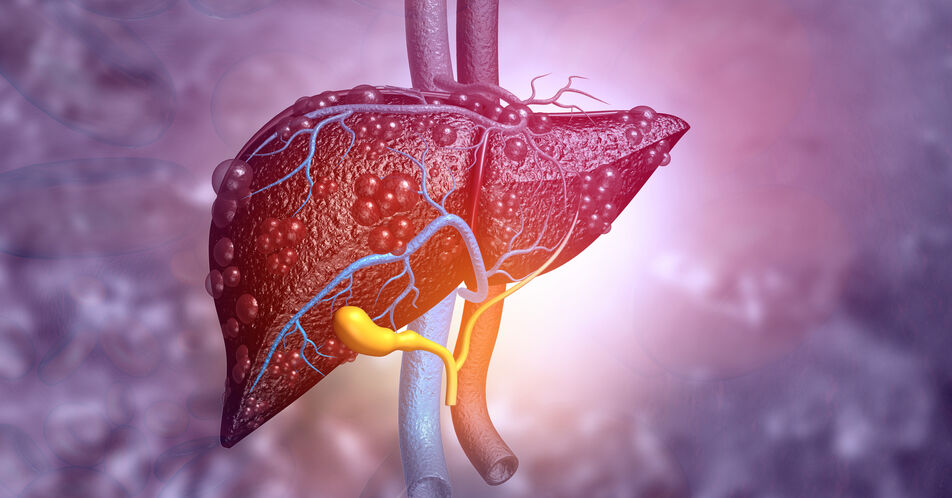 Mikrobiom-Signaturen ermöglichen präzise Diagnosen der NAFLD